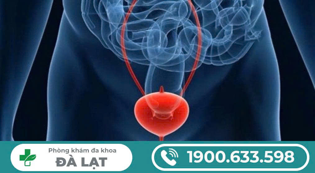 Hình ảnh minh họa